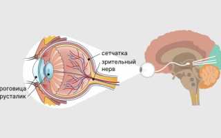 Микропсия: это не весело, это — опасно. Микропсия Лечение синдрома алисы в стране чудес