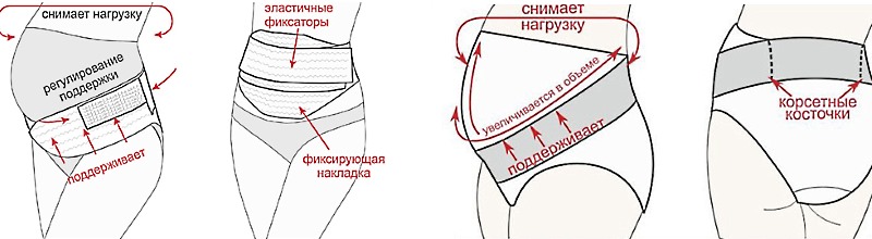 При болях в спине в период беременности особое внимание следует уделять ношению бандажа