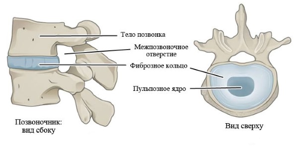 При хондрозе дистрофические изменения затрагивают только межпозвонковый диск