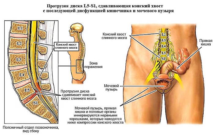 Обратите внимание, что значит синдром конского хвоста