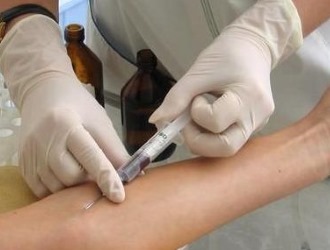 При межреберной невралгии обычно назначают около 10-15 сеансов массажа