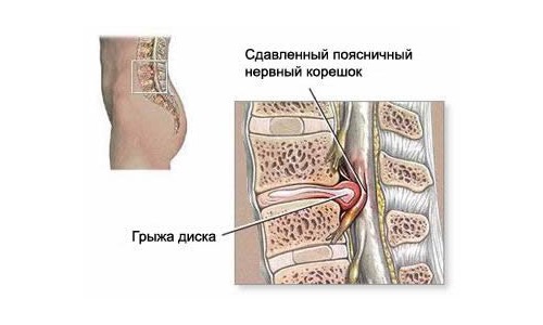 Препарат обладает миорелаксирующим действием