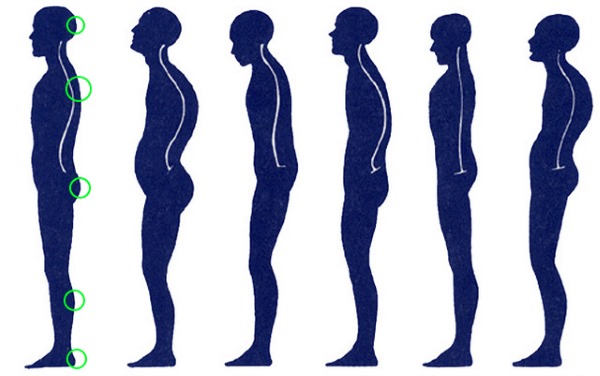 При нормальной осанке на теле имеется 5 точек соприкосновения со стеной