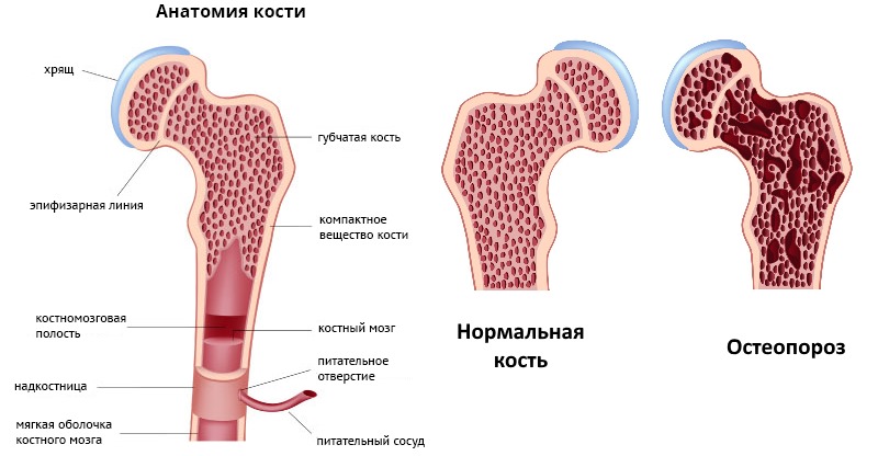 Используют препарат Пролиа для лечения остеопороза