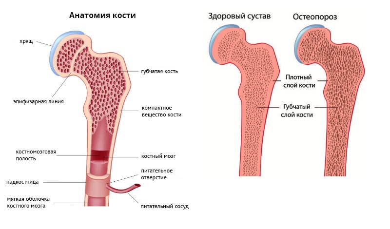 Основным показанием к применению Акласты является остеопороз