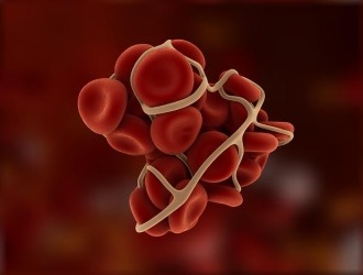 Нельзя использовать Костарокс при гемофилии