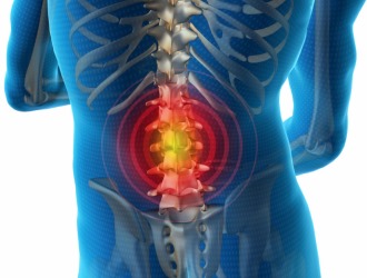 Все лечение при выпадении межпозвоночного диска направлено на устранение воспаления