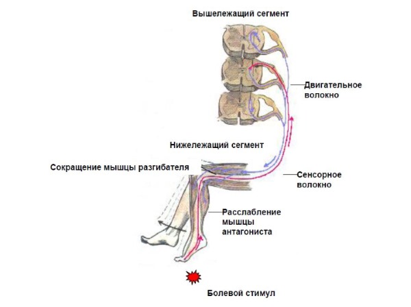Назначают Нурофен Экспресс Леди для купирования различных болей у женщин, в частности менструальных