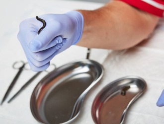 Ознакомьтесь со списком противопоказаний к использованию гирудотерапии