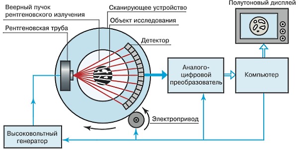 Компьютерный томограф похож по действию с рентгенографией