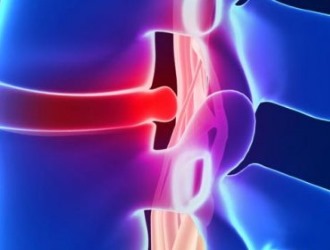 Категорически противопоказаны какие-либо прогревания при обострении грыжи