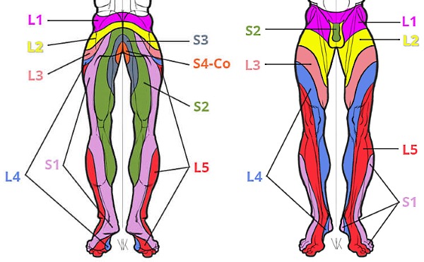 С увеличением выпячивания появляются боли в ногах, локализация которой зависит от места развития протрузии
