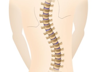 Йога категорически запрещена при сколиозе 4 степени