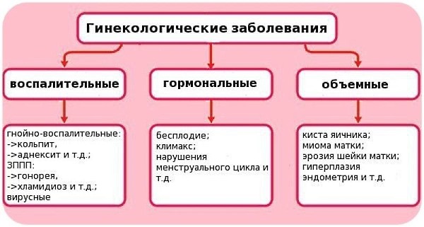 Обратите внимание какие гинекологические заболевания могут вызывать неприятные ощущения в пояснице