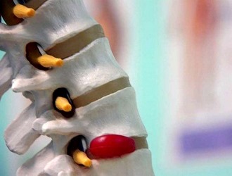 Плавание полезно при тех заболеваниях позвоночника, которые вызывают компрессию позвонков и нервов