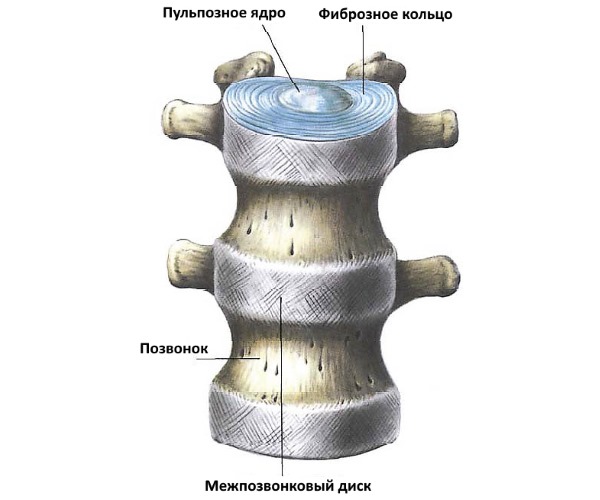 Хондроз - дегенеративный процесс позвоночника, который начинается с дисков