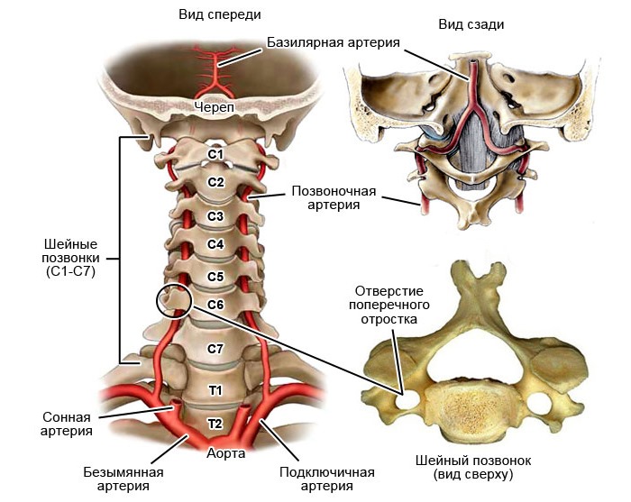Вертебро-базилярная недостаточность возникает из-за плохого кровотока в базилярной артерии