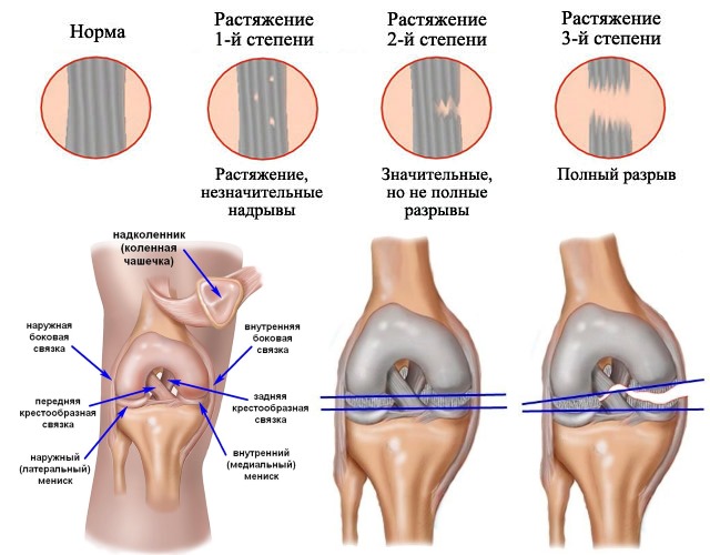 Ниже представлен подробный список заболеваний, при которых используют Фастум гель