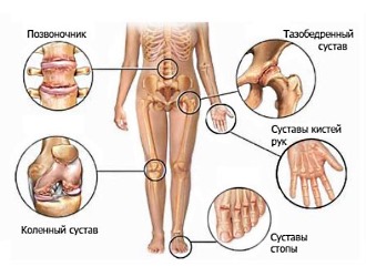 Ознакомьтесь с полным списком показаний к применению крема Здоров