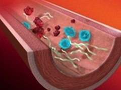 движение по сосуду