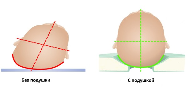 На ортопедической подушке голова младенца фиксируется в правильном положении