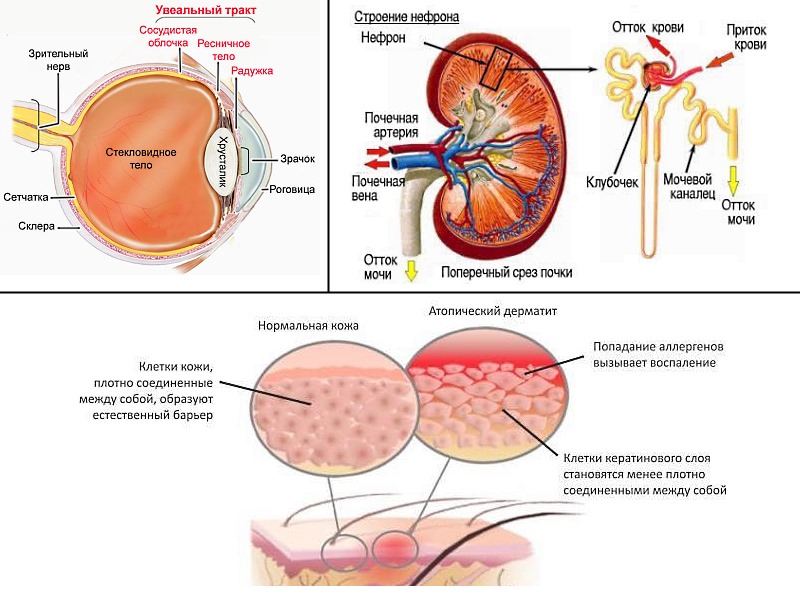 Заболевания при которых применяют Сандиммун Неорал