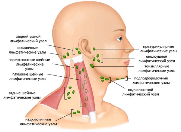 Часто при застуживании шейных мышц воспаляются лимфоузлы