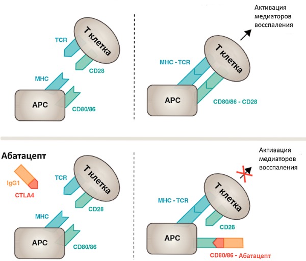 Оренсия блокирует воздействие Т-лимфоцитов, устраняя воспаление