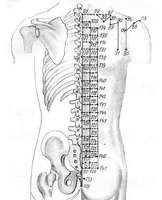 Обратите внимание куда устанавливаются иглы при межпозвоночной грыже