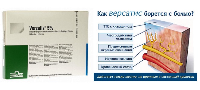 Версатис действует местно и его вещества не попадают в кровеносную систему
