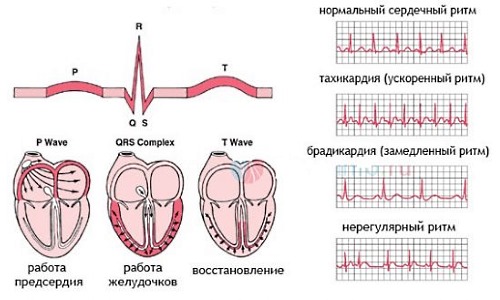 Передозировка препаратом может нарушить сердечный ритм