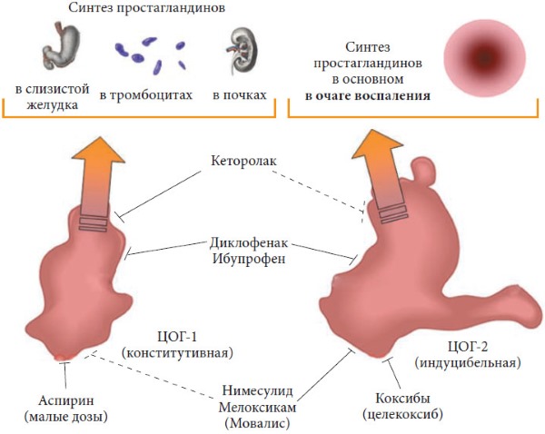 Диклоран относится к НПВС и обладает тремя свойствами: обезболивающим, противовоспалительным и жаропонижающим