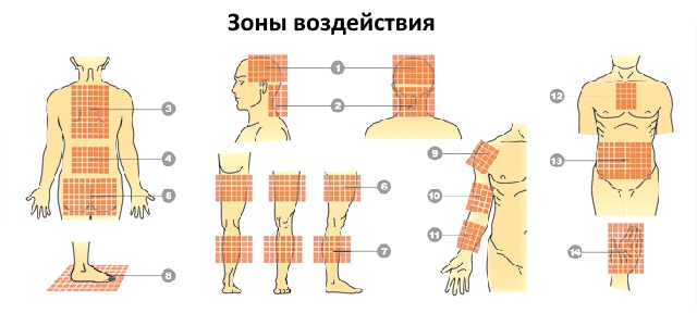 Ознакомьтесь с местами расположения зон воздействия аппликатора
