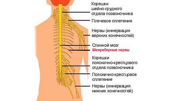 При межреберной невралгии возникает острая боль, так как происходит пережатие нервных корешков