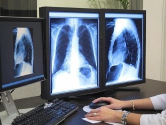 Ортопед для установления диагноза может назначить рентгенографию