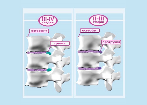 Данный этап является самым запущенный и иногда требует радикальных мер