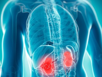 Люди с проблемами в работе почек страдают от побочных эффектов чаще