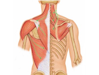 Сколиоз бывает мышечным - развивается по причине плохого развития мышц спины