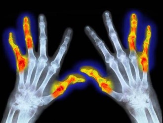 Препарат быстро устраняет болевой синдром