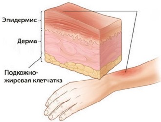 Нельзя наносить препарат на поврежденные участки кожи