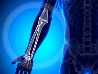 Женщины принимавшие СИОЗС чаще страдали от переломов костей