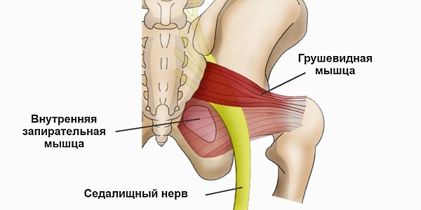 Ишиас может быть спровоцирован спазмом грушевидной мышцы
