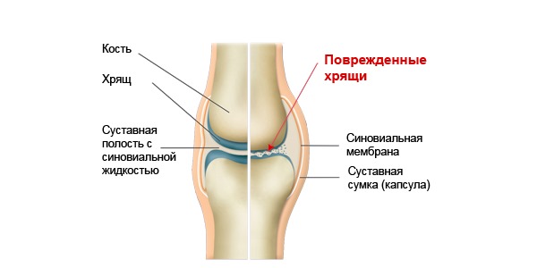 Сустафаст применяют для лечения суставов и хрящевой ткани в целом
