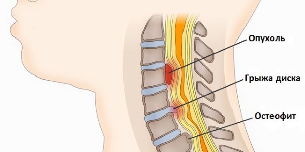 Ниже приведен список показаний к проведению МРТ шеи