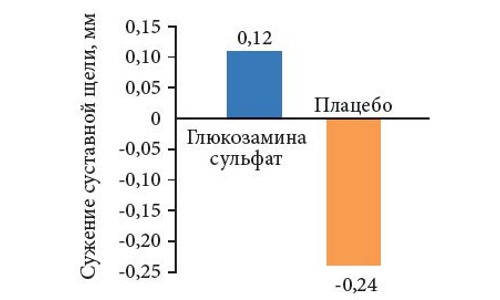 Наиболее эффективен Глюкозамин в комплексе с хондроитином и коллагеном