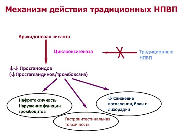 НПВС - первая группа препаратов, которая назначается при межпозвоночной грыже в пояснице