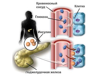 Людям с диабетом стоит отказаться от приема НПВС