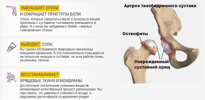 Преимущества геля Artrotok