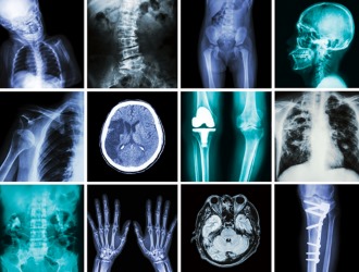 Пациенты и врачи оценивают препарат положительно