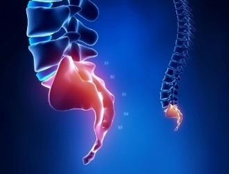 Если не принять меры при травмировании крестца, может появиться кокцигодиния